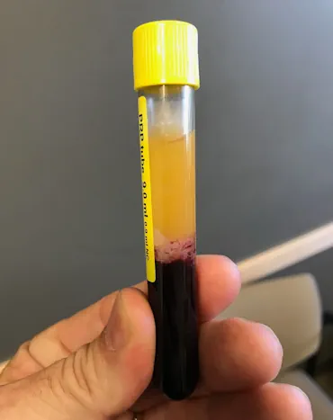 Selphyl Test Vial